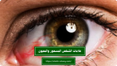 أعراض سحر النظرة