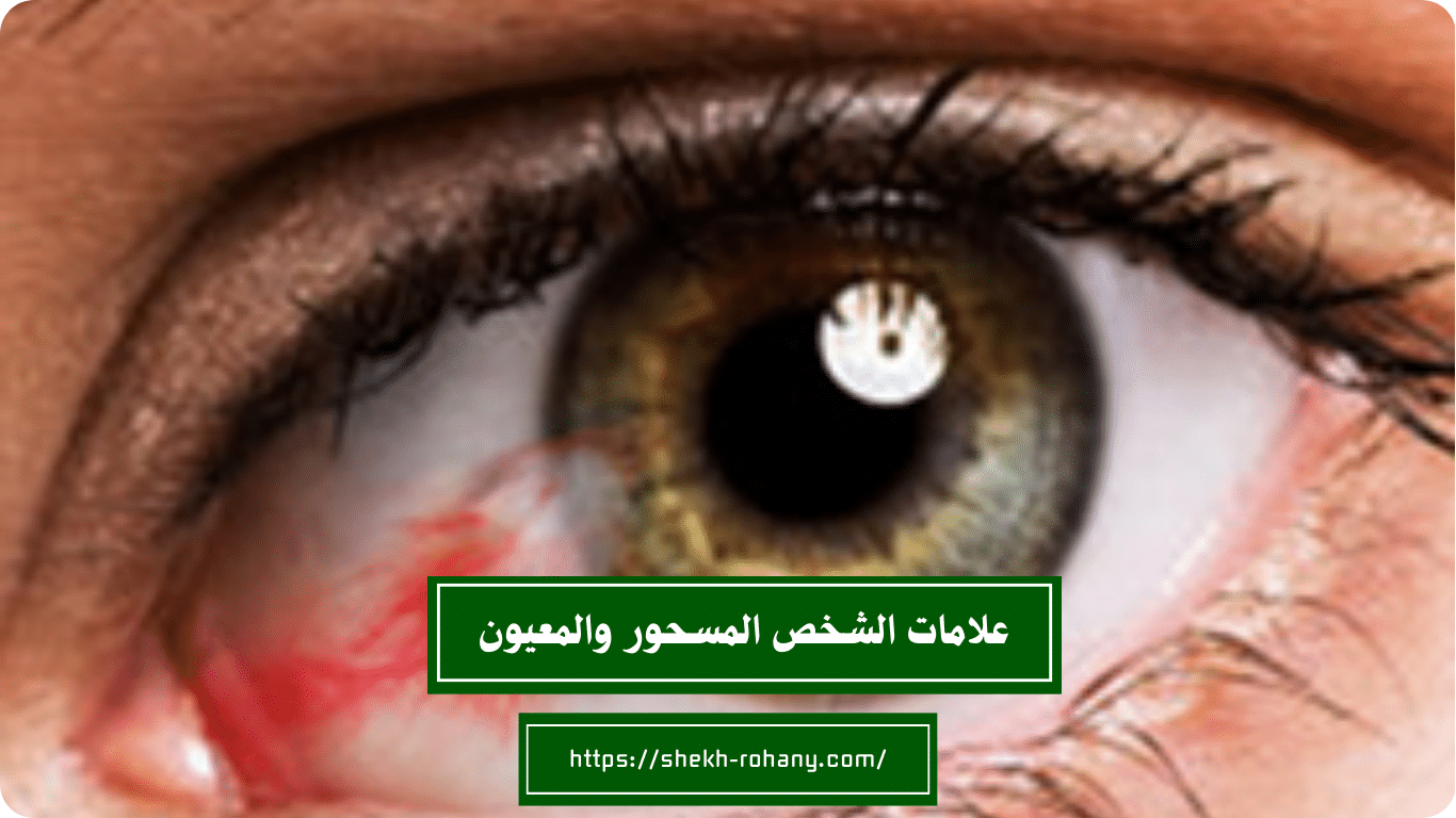 أعراض سحر النظرة